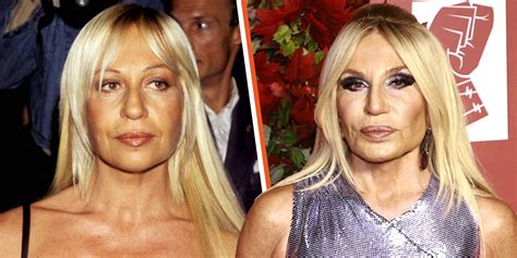 donatella versace before surgery|See Donatella Versace's Shocking Transformation .